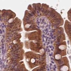 Invitrogen SAT2 Polyclonal Antibody 100 &mu;L; Unconjugated:Antibodies,