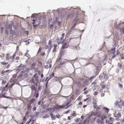 Invitrogen SAT2 Polyclonal Antibody 100 &mu;L; Unconjugated:Antibodies,