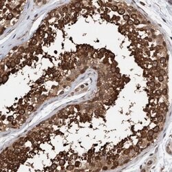 Invitrogen Synip Polyclonal Antibody 100 &mu;L; Unconjugated:Antibodies,
