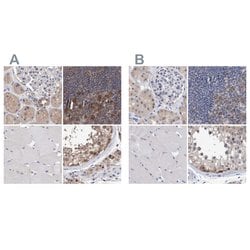 Invitrogen PFAS Polyclonal Antibody 100 &mu;L; Unconjugated:Antibodies,