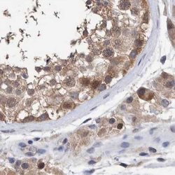Invitrogen PFAS Polyclonal Antibody 100 &mu;L; Unconjugated:Antibodies,