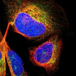 Invitrogen CDK5RAP3 Polyclonal Antibody 100 &mu;L | Buy Online | Invitrogen&trade; | Fisher Scientific