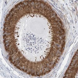 Invitrogen CDK5RAP3 Polyclonal Antibody 100 &mu;L | Buy Online | Invitrogen&trade; | Fisher Scientific