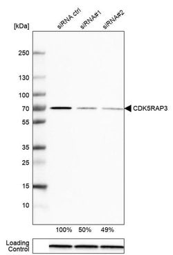 Invitrogen CDK5RAP3 Polyclonal Antibody 100 &mu;L | Buy Online | Invitrogen&trade; | Fisher Scientific