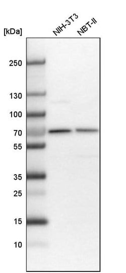 Invitrogen CDK5RAP3 Polyclonal Antibody 100 &mu;L | Buy Online | Invitrogen&trade; | Fisher Scientific