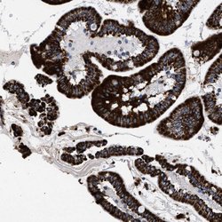 Invitrogen ACADS Polyclonal Antibody 100 &mu;L; Unconjugated:Antibodies,