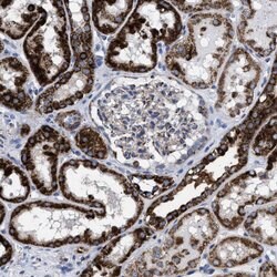 Invitrogen ACADS Polyclonal Antibody 100 &mu;L; Unconjugated:Antibodies,