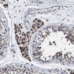 Invitrogen ACADS Polyclonal Antibody 100 &mu;L; Unconjugated:Antibodies,