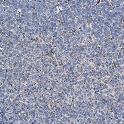 Invitrogen ACADS Polyclonal Antibody 100 &mu;L; Unconjugated:Antibodies,