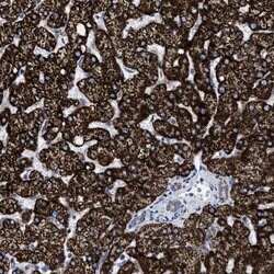 Invitrogen ACADS Polyclonal Antibody 100 &mu;L; Unconjugated:Antibodies,