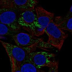 Invitrogen ACADS Polyclonal Antibody 100 &mu;L; Unconjugated:Antibodies,