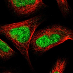 Invitrogen ZNF462 Polyclonal Antibody 100 &mu;L; Unconjugated:Antibodies,