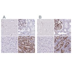 Invitrogen PITPNM3 Polyclonal Antibody 100 &mu;L; Unconjugated:Antibodies,
