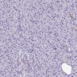 Invitrogen PITPNM3 Polyclonal Antibody 100 &mu;L; Unconjugated:Antibodies,