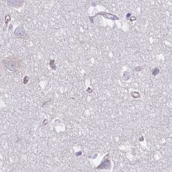 Invitrogen PITPNM3 Polyclonal Antibody 100 &mu;L; Unconjugated:Antibodies,