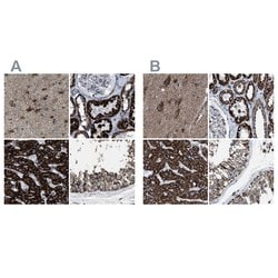 Invitrogen ECHS1 Polyclonal Antibody 100 &mu;L; Unconjugated:Antibodies,