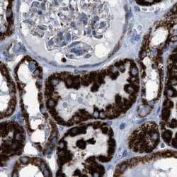 Invitrogen ECHS1 Polyclonal Antibody 100 &mu;L; Unconjugated:Antibodies,