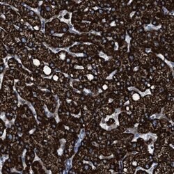 Invitrogen ECHS1 Polyclonal Antibody 100 &mu;L; Unconjugated:Antibodies,