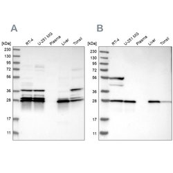 Invitrogen ECHS1 Polyclonal Antibody 100 &mu;L; Unconjugated:Antibodies,
