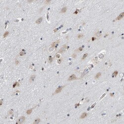 Invitrogen POLR1E Polyclonal Antibody 100 &mu;L; Unconjugated:Antibodies,