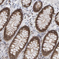 Invitrogen POLR1E Polyclonal Antibody 100 &mu;L; Unconjugated:Antibodies,