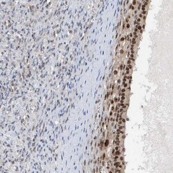 Invitrogen POLR1E Polyclonal Antibody 100 &mu;L; Unconjugated:Antibodies,