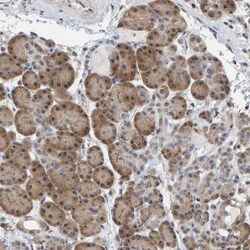 Invitrogen POLR1E Polyclonal Antibody 100 &mu;L; Unconjugated:Antibodies,