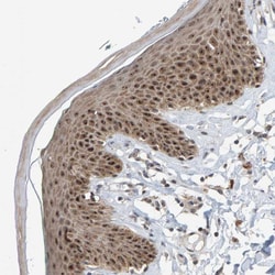 Invitrogen POLR1E Polyclonal Antibody 100 &mu;L; Unconjugated:Antibodies,