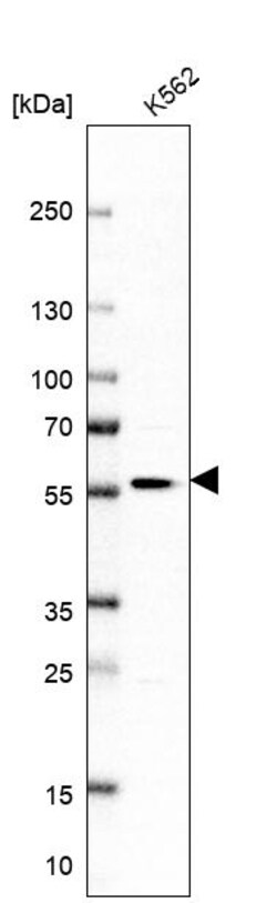 Invitrogen POLR1E Polyclonal Antibody 100 &mu;L | Buy Online | Invitrogen&trade; | Fisher Scientific