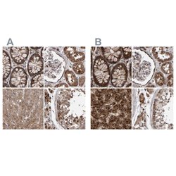 Invitrogen PECR Polyclonal Antibody 100 &mu;L; Unconjugated:Antibodies,