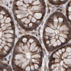 Invitrogen PECR Polyclonal Antibody 100 &mu;L; Unconjugated:Antibodies,