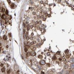 Invitrogen PECR Polyclonal Antibody 100 &mu;L; Unconjugated:Antibodies,