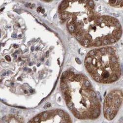 Invitrogen PECR Polyclonal Antibody 100 &mu;L; Unconjugated:Antibodies,