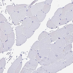 Invitrogen Laminin gamma-3 Polyclonal Antibody 100 &mu;L; Unconjugated:Antibodies,