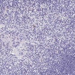 Invitrogen Laminin gamma-3 Polyclonal Antibody 100 &mu;L; Unconjugated:Antibodies,
