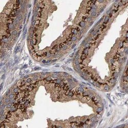 Invitrogen CANT1 Polyclonal Antibody 100 &mu;L; Unconjugated:Antibodies,