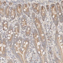 Invitrogen ITPA Polyclonal Antibody 100 &mu;L; Unconjugated:Antibodies,