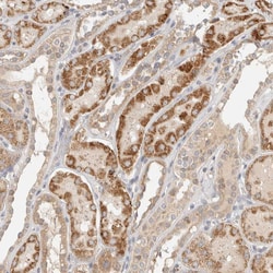 Invitrogen ITPA Polyclonal Antibody 100 &mu;L; Unconjugated:Antibodies,