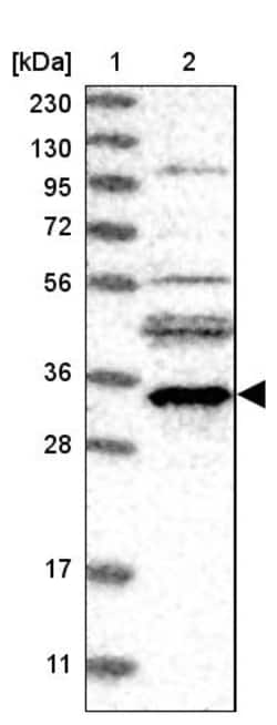 Invitrogen TTC35 Polyclonal Antibody 100 &mu;L; Unconjugated:Antibodies,