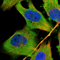 Invitrogen EXOC7 Polyclonal Antibody 100 &mu;L; Unconjugated:Antibodies,