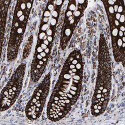 Invitrogen MRPL12 Polyclonal Antibody 100 &mu;L; Unconjugated:Antibodies,