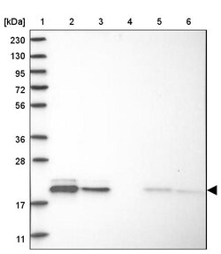 Invitrogen MRPL12 Polyclonal Antibody 100 &mu;L; Unconjugated:Antibodies,