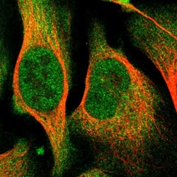 Invitrogen CoA Synthase Polyclonal Antibody 100 &mu;L; Unconjugated:Antibodies,