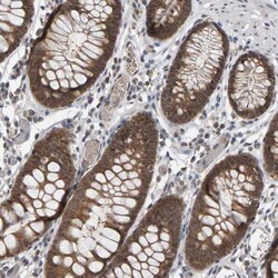 Invitrogen CoA Synthase Polyclonal Antibody 100 &mu;L; Unconjugated:Antibodies,