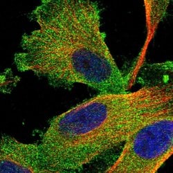 Invitrogen Synip Polyclonal Antibody 100 &mu;L; Unconjugated:Antibodies,