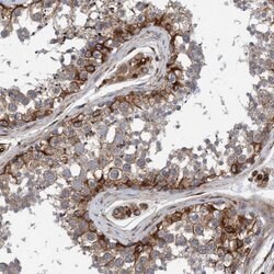 Invitrogen Synip Polyclonal Antibody 100 &mu;L; Unconjugated:Antibodies,