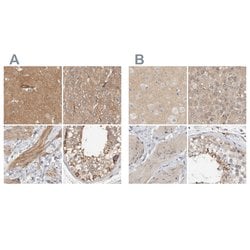 Invitrogen MPRIP Polyclonal Antibody 100 &mu;L; Unconjugated:Antibodies,
