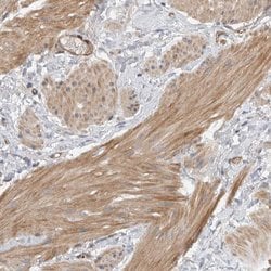 Invitrogen MPRIP Polyclonal Antibody 100 &mu;L; Unconjugated:Antibodies,