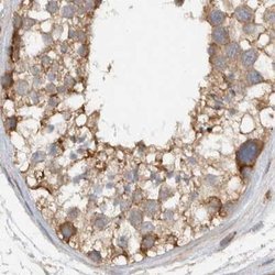 Invitrogen MPRIP Polyclonal Antibody 100 &mu;L; Unconjugated:Antibodies,