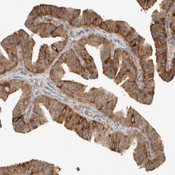 Invitrogen LLGL2 Polyclonal Antibody 100 &mu;L; Unconjugated:Antibodies,